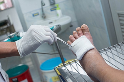 Causes and Treatment of Diabetic Foot Ulcers